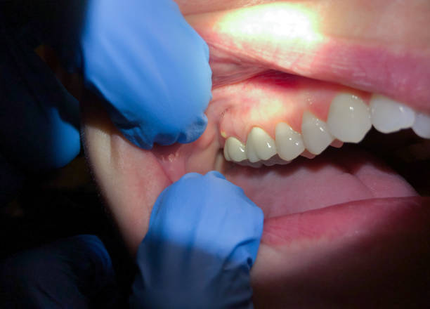 Best 24-Hour Emergency Dental Care in Dorneyville, PA